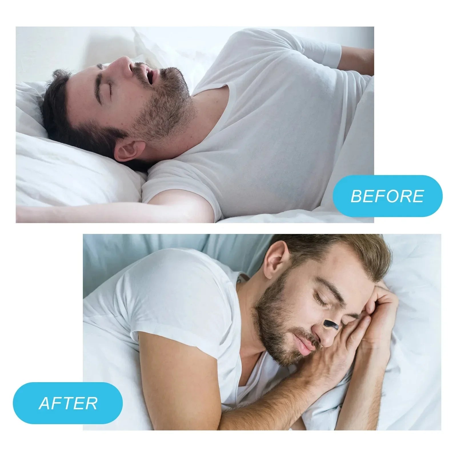 Anti-Snoring Nose Clip - Nasal Breathing Dilators for Better Sleep - Image 4
